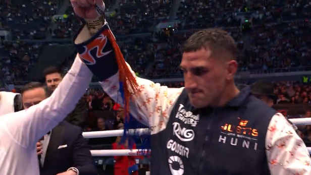 Huni's Netflix fight hijacked by 'very petty' legal battle